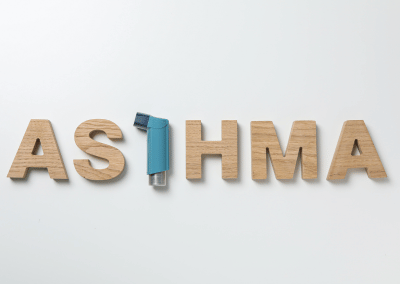 Illustration of asthma-affected airways with constriction and inflammation