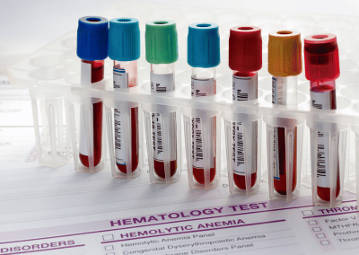 Hematology test and strep screening for detecting blood disorders and infections