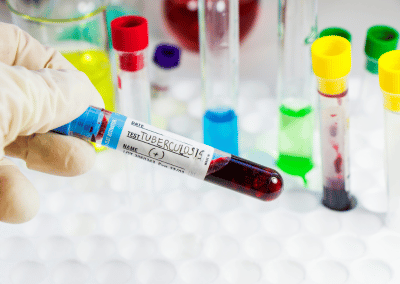 Tuberculosis and mono testing procedures at an urgent care clinic