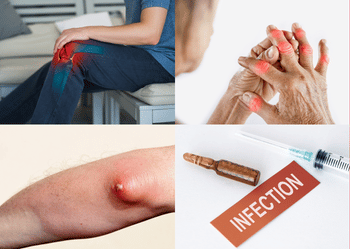 List of conditions treated with joint aspiration and injection therapy