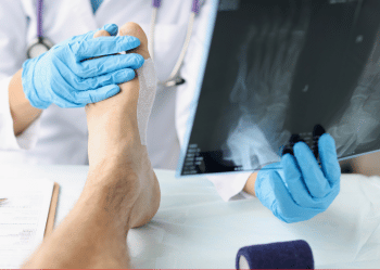 X-ray image revealing a bone fracture used for diagnostic evaluation