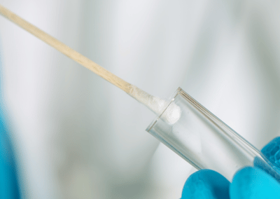 Rapid flu test being administered for quick results at urgent care