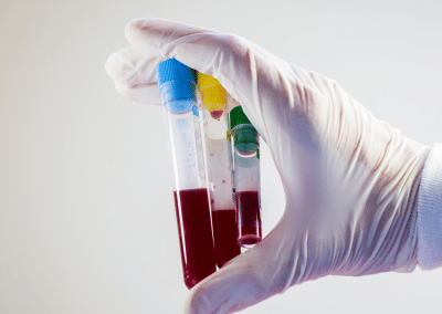 Overview of diagnostic tests offered at Urgent Care of Oconee